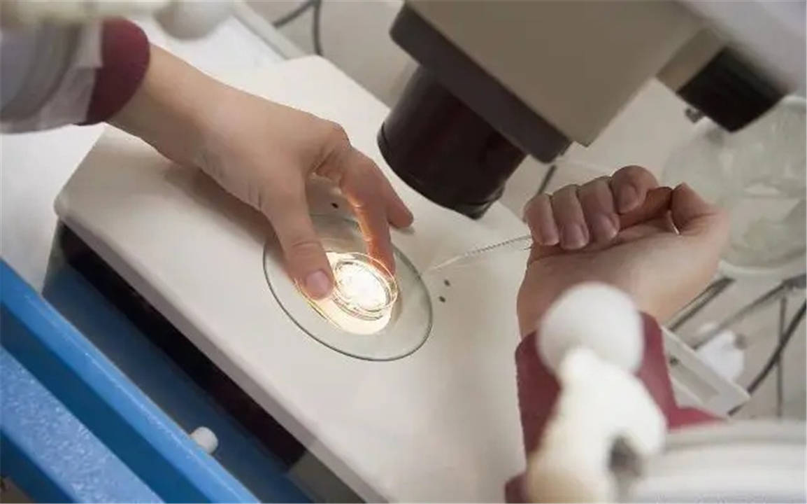 经期第五天自慰 子宫内膜异位症 月经子宫内膜异位症